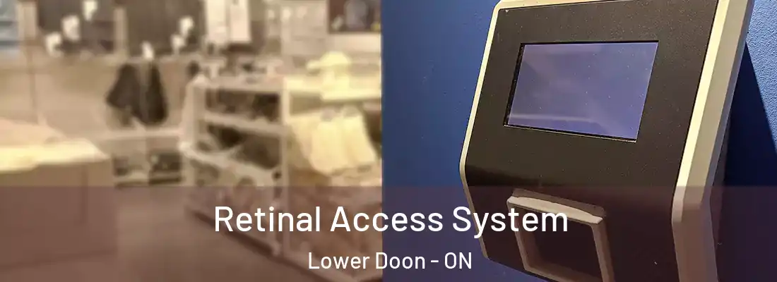  Retinal Access System Lower Doon - ON
